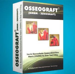 Advanced Biotech Osseograft
