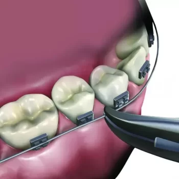 GDC Weingart Utility Plier - Image 4