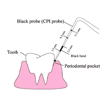 GDC Double End Probes Unc 15 / Screening Probe #1 (PCP15/11.5) - Image 2