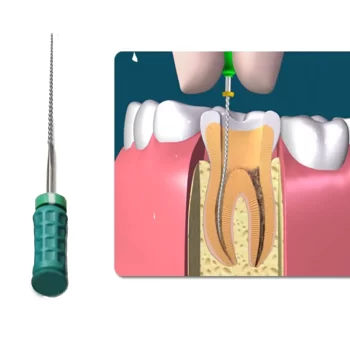 Dentsply M-Access K-Files 25mm (Hand Operated Files) - Image 3